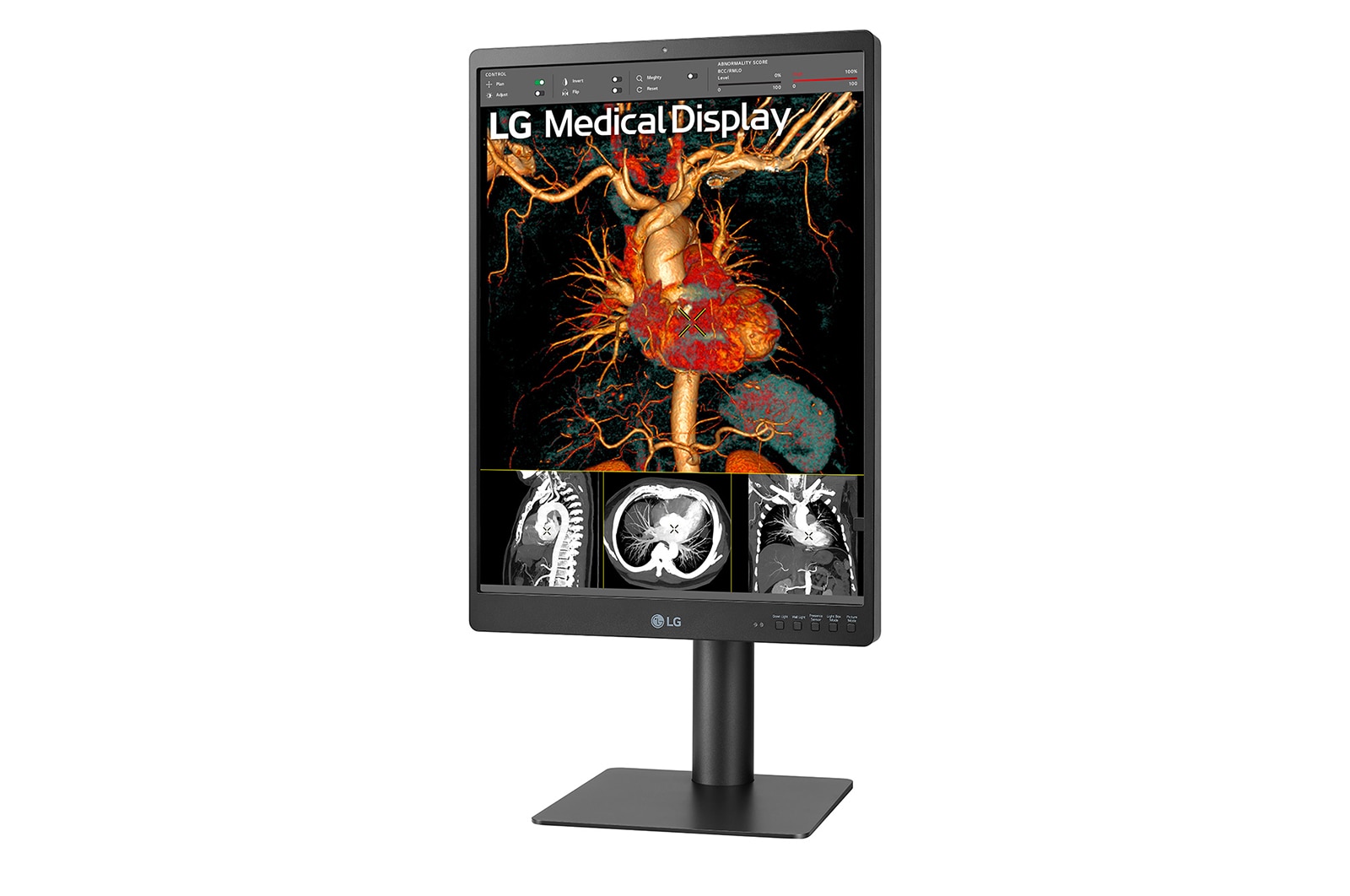 LG 21.3'' 3MP IPS Diagnostic Monitor, 21HQ513D-B