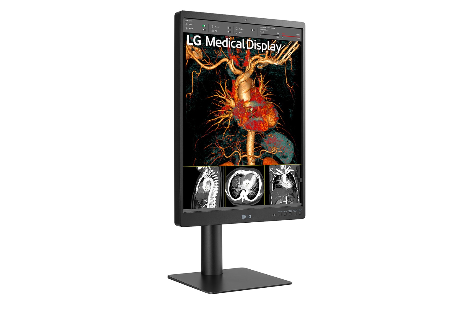 LG 21.3'' 3MP IPS Diagnostic Monitor, 21HQ513D-B