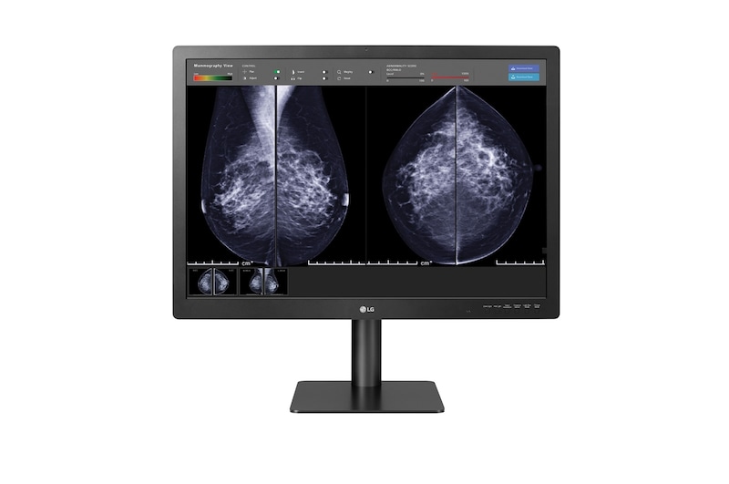 LG  LG 31'' 12MP 4200 x 2800 IPS Diagnostic Monitor for Mammography, 31HN713D-B