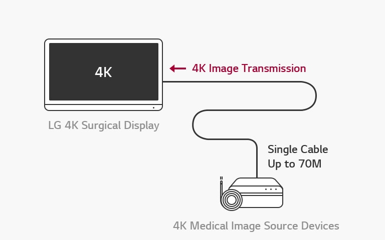 12G-SDI Support : LG 4K Surgical Display enables long-distance transmission of 4K signals over a single coaxial cable without latency for stable surgery.