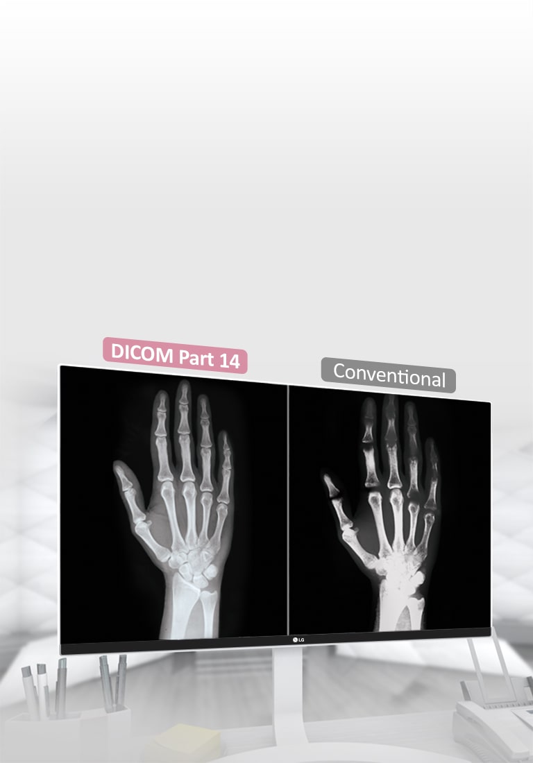DICOM Part 14