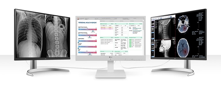 LG 24CR670NK supports up to 4K UHD resolution dual displays. With flexibility for multi-monitor set-up options, you can get more done in less time.
