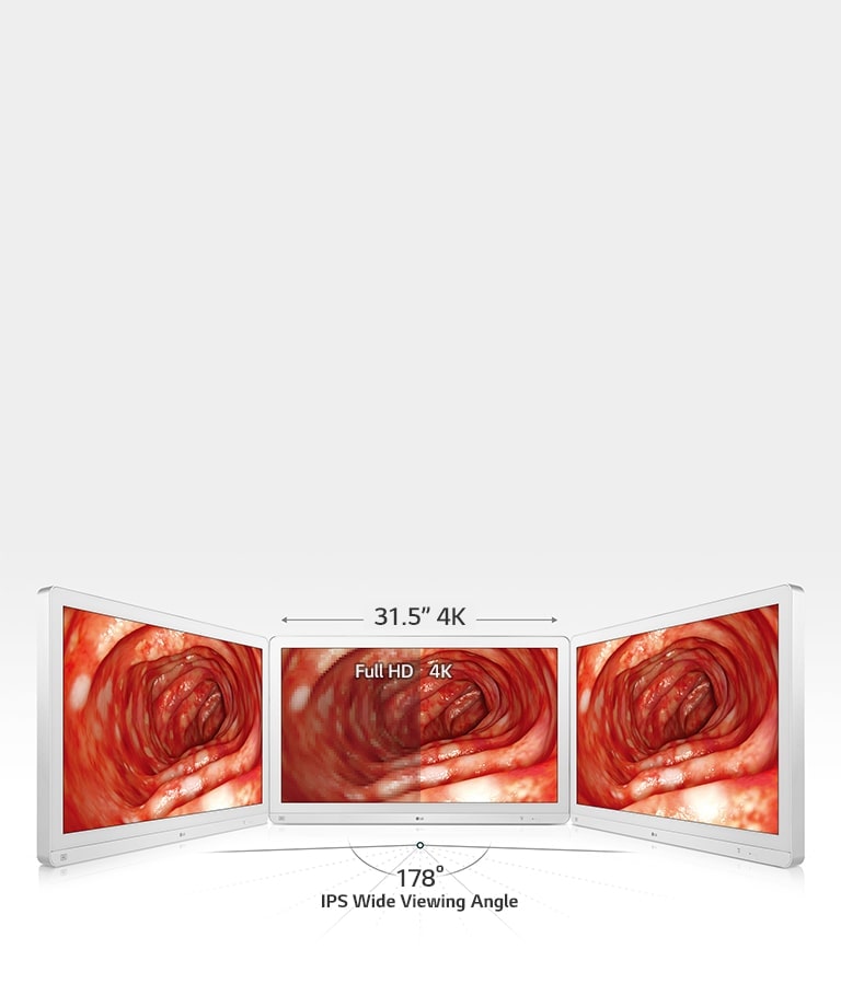 Enhanced Accuracy with Wide View
