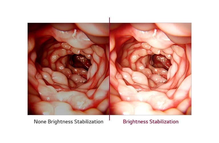 Brightness Stabilization
