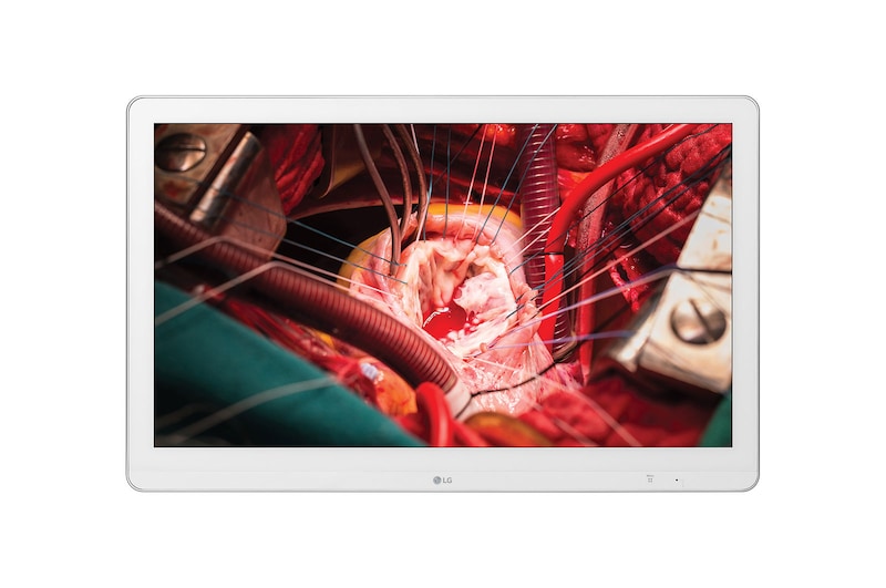 LG Moniteur chirurgical pleine HD de LG  , 27HK510S-W