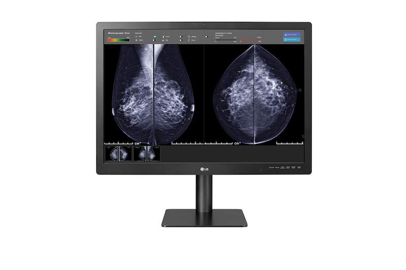 LG Moniteur de diagnostic pour mammographie de 31 pouces et 12Mpx de LG, 31HN713D-B