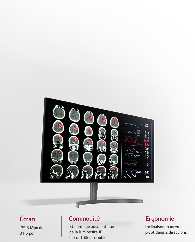 Écran de diagnostic 8 Mpx de 31,5 po.