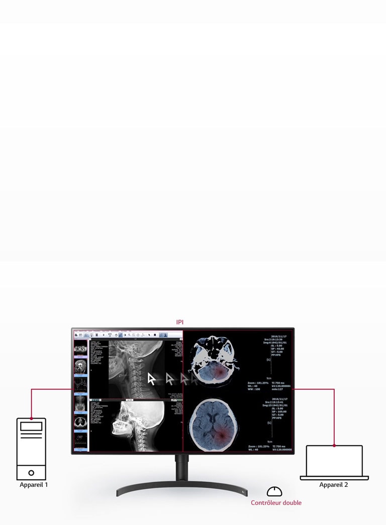 Plusieurs signaux sur un seul écran