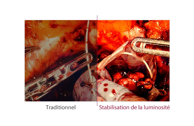 Stabilisation de la luminosité