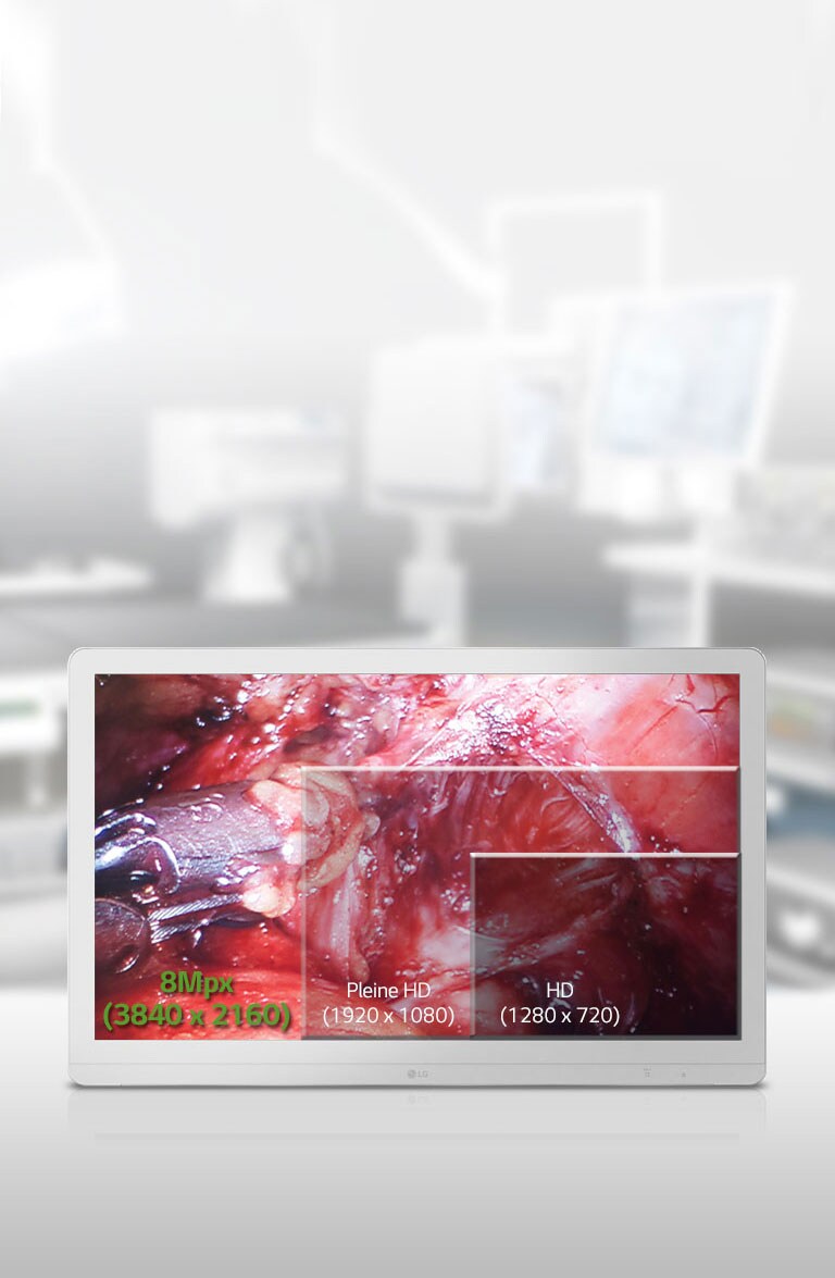 Écran UHD IPS haut de gamme de 8Mpx de 27 po