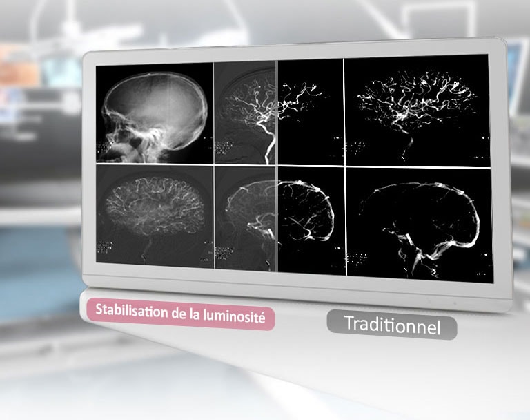 Section 14 de la norme DICOM et stabilisation de la luminosité