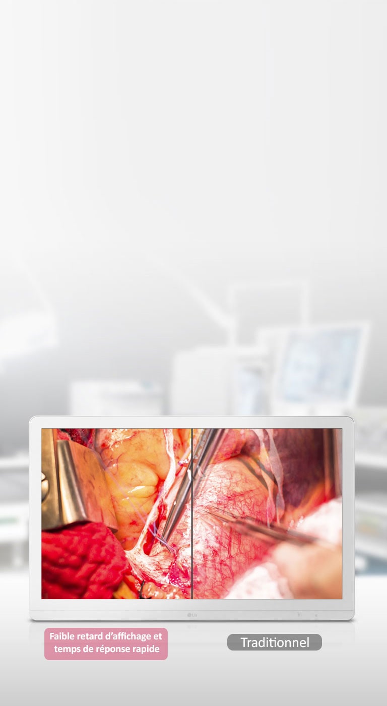 Mode de synchronisation dynamique et temps de réponse rapide