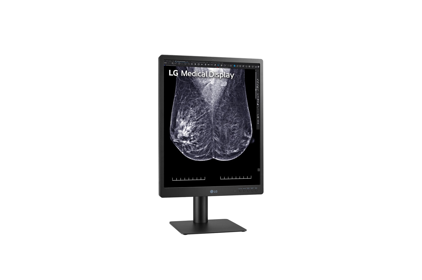 -15 degree side view