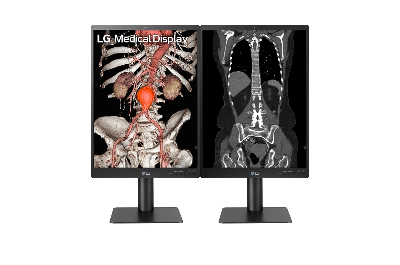 LG Moniteur de diagnostic IPS 21.3'' 3 mpx de LG, 21HQ513D-B