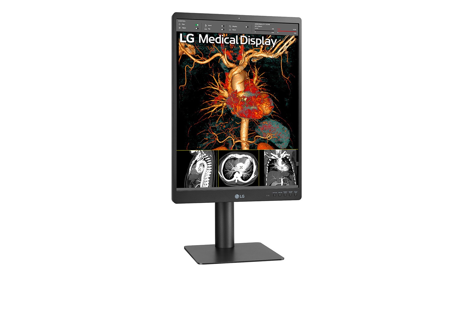 LG Moniteur de diagnostic IPS 21.3'' 3 mpx de LG, 21HQ513D-B