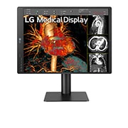 LG Moniteur de diagnostic IPS 21.3'' 3 mpx de LG, 21HQ513D-B