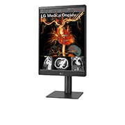 LG Moniteur de diagnostic IPS 21.3'' 3 mpx de LG, 21HQ513D-B