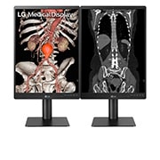 LG Moniteur de diagnostic IPS 21.3'' 3 mpx de LG, 21HQ513D-B