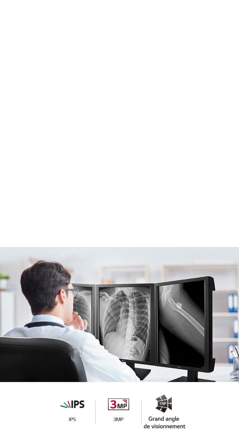 Qualité d’image précise