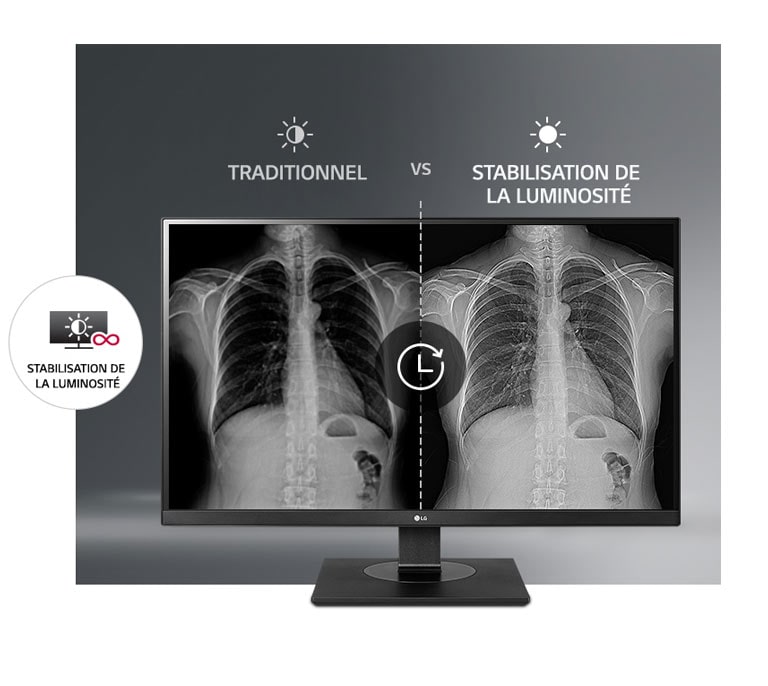 Stabilité de la luminosité