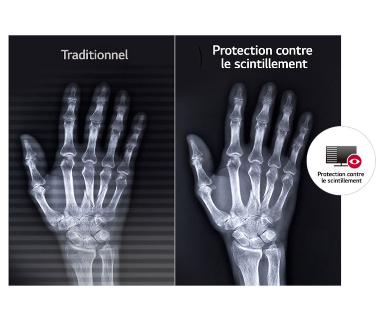 Pas de scintillement