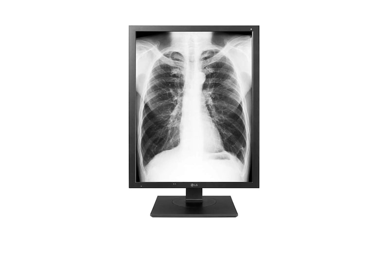 LG 21'' Monitor de diagnóstico LG de 3MP, 21HK512D-B
