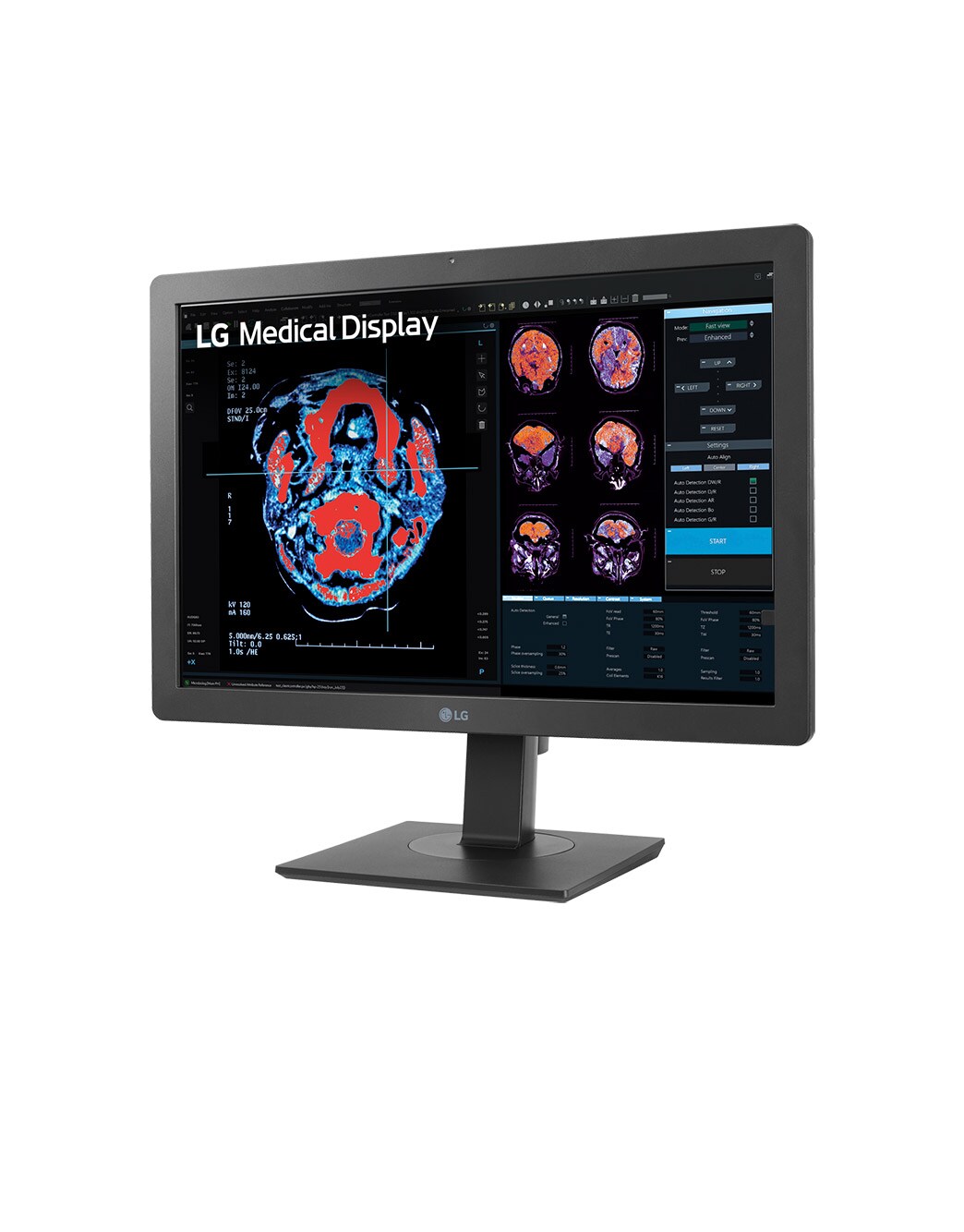 LG 24” 2MP IPS Clinical Review Monitor | LG Chile
