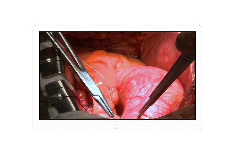 Vista frontal de 8MP Surgical Monitor 27HJ710S-W