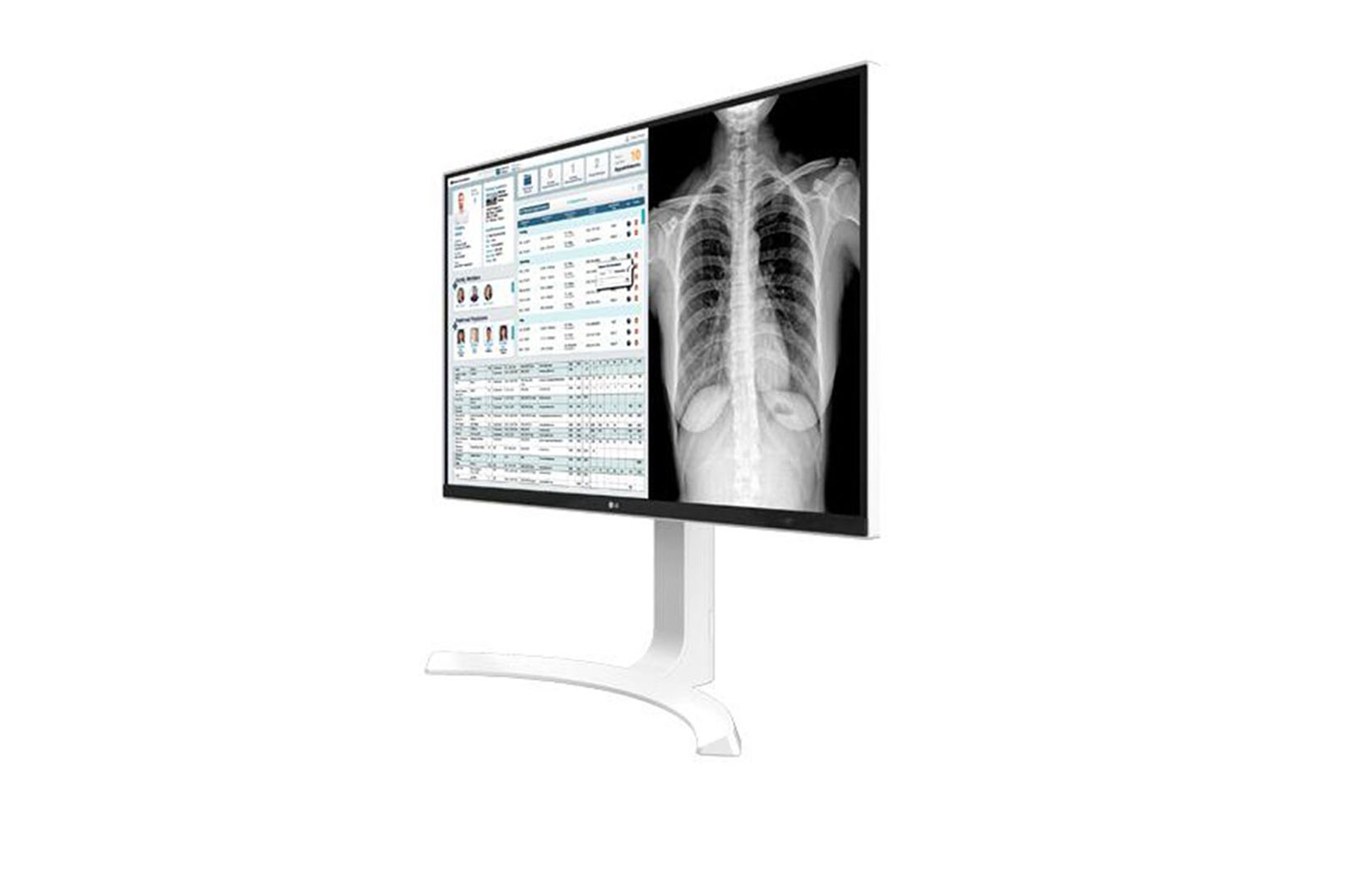 LG 27'' 8MP(3840x2160) IPS Clinical Review Monitor , 27HJ712C-W