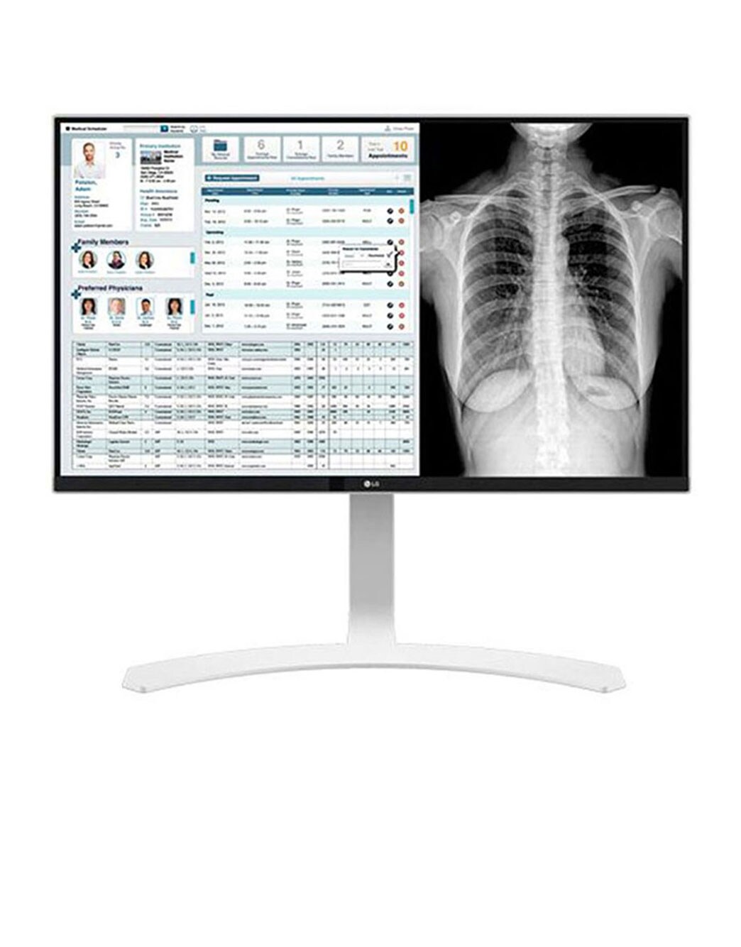 27'' 8MP(3840x2160) IPS Clinical Review Monitor | LG Chile