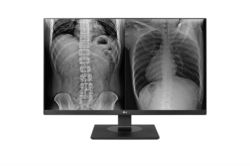 Vista frontal de 27'' 8MP(3840x2160) IPS Clinical Review Monitor 27HJ713C-B