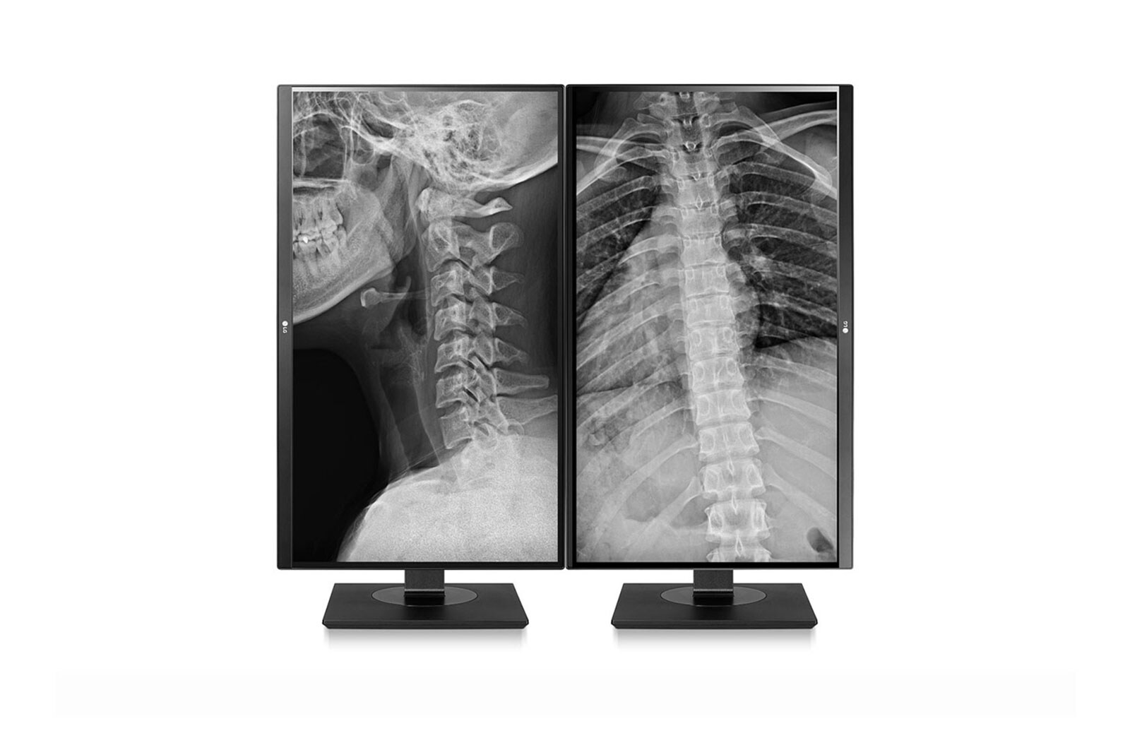 LG 27'' 8MP(3840x2160) IPS Clinical Review Monitor, 27HJ713C-B