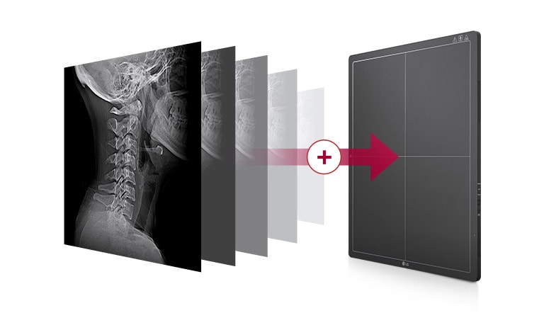 Una memoria incorporada que almacena automáticamente las imágenes tomadas en el detector, hasta 200 imágenes