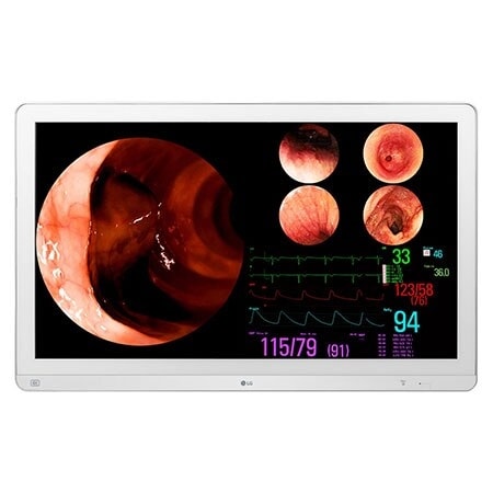 front view with mammography imaging results on the screen
