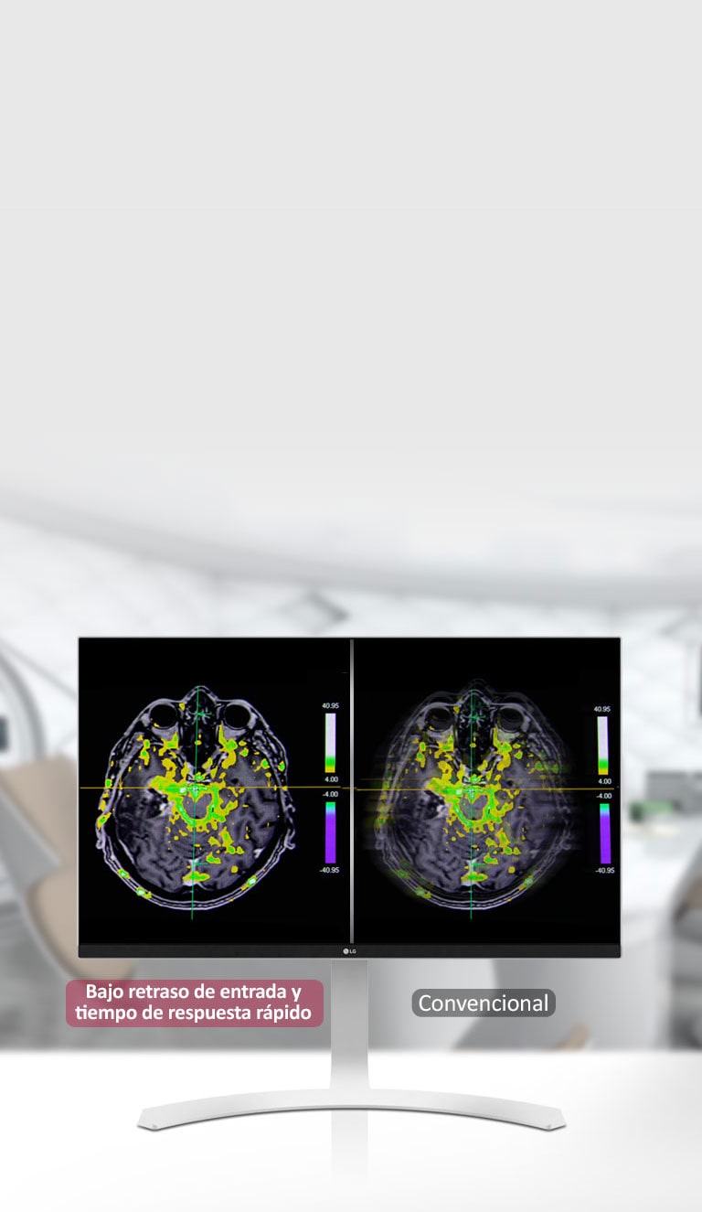 Tiempo de respuesta rápida