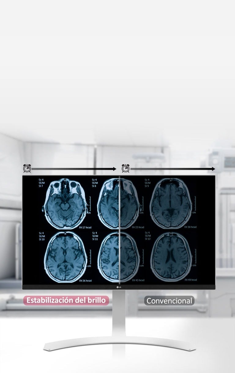 Estabilización del brillo