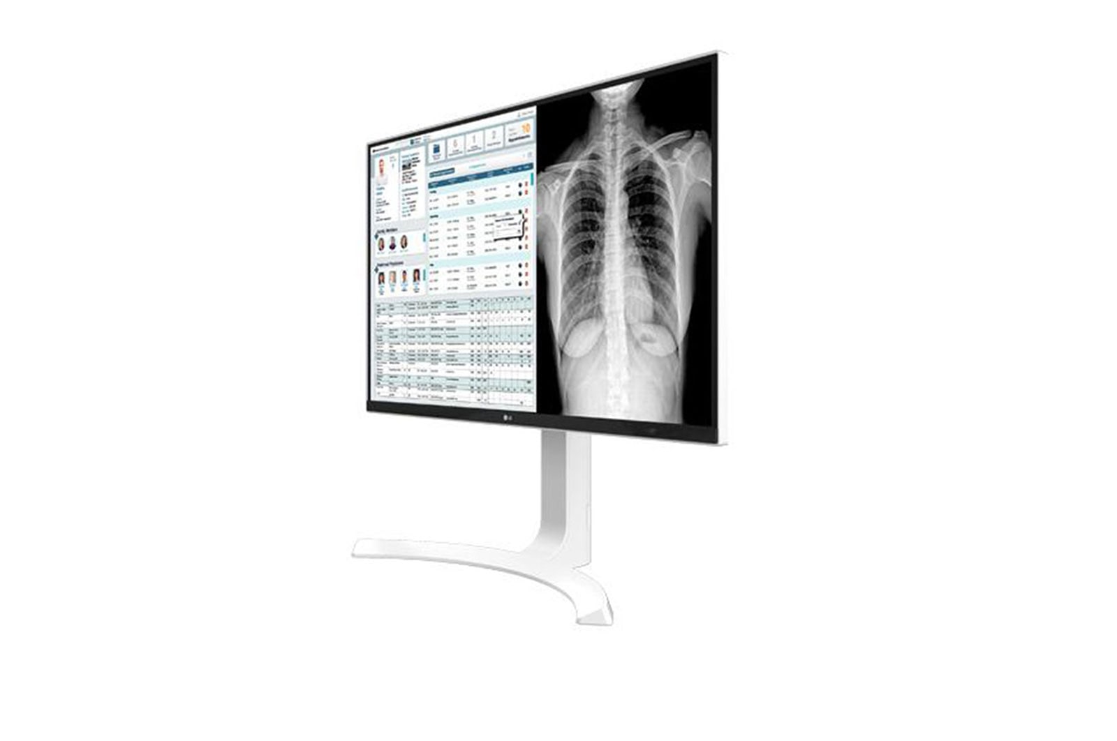LG Monitor Clinico 8MP, 27HJ712C-W