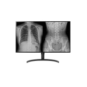 LG 31.5'' 8MP (3840x2160) Monitor de diagnóstico Nano IPS, 32HL512D-B