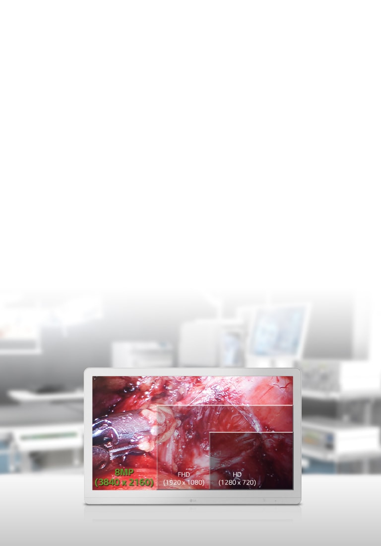 Pantalla optimizada para la sala de operaciones1