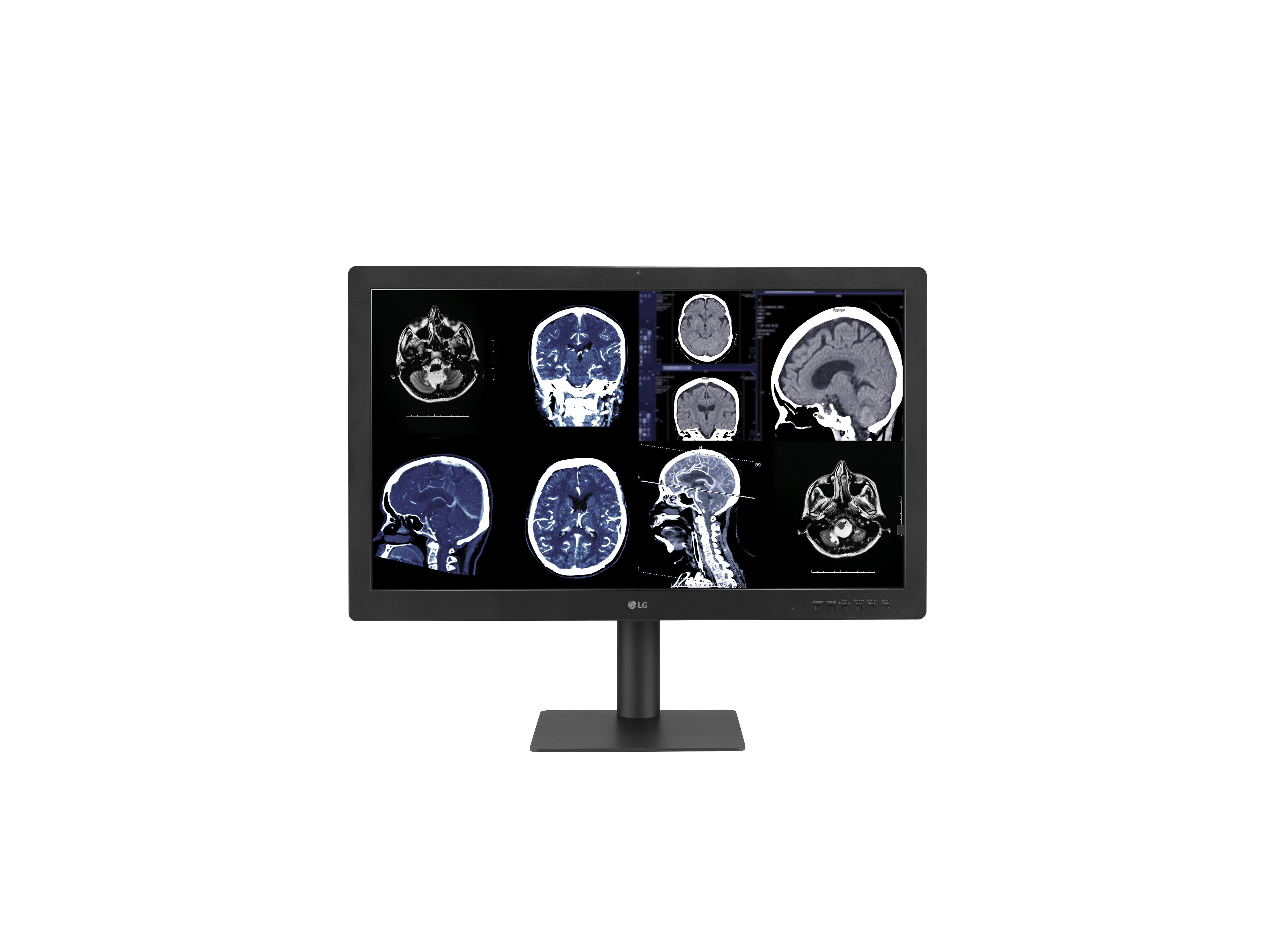 Diagnosemonitor