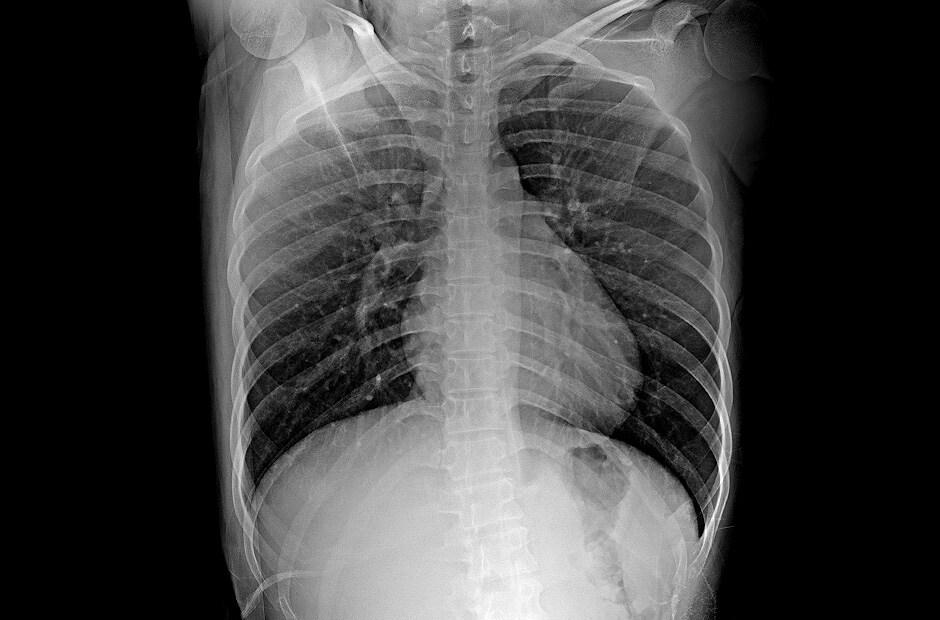 Hochauflösende und klare diagnostische Bildgebung durch den Einsatz von LG DXD.