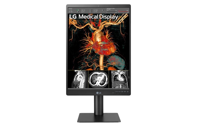 LG 21,3-Zoll-IPS-Diagnosemonitor mit 3 MP, 21HQ513D-B