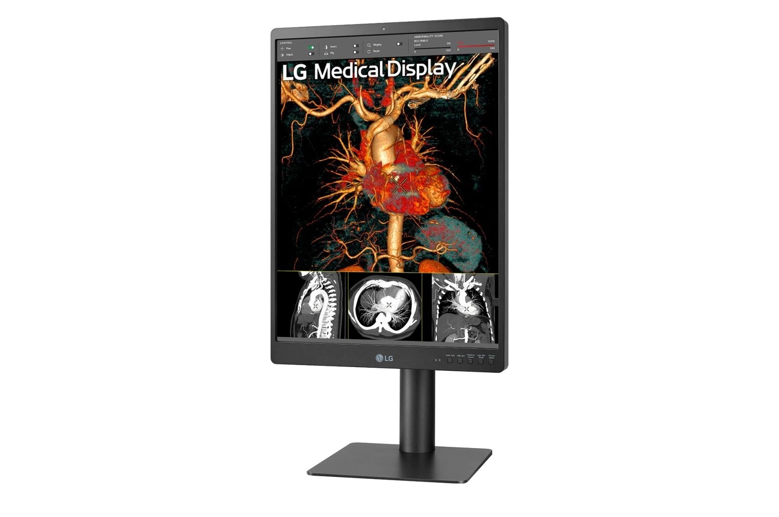 LG 21,3-Zoll-IPS-Diagnosemonitor mit 3 MP, 21HQ513D-B