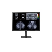 Vorderseite von 31 Zoll 12 MP Mammographie Diagnosemonitor mit IPS 31HN713D-BA