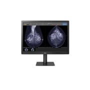 LG 31 Zoll 12 MP Mammographie Diagnosemonitor mit IPS, 31HN713D-BA