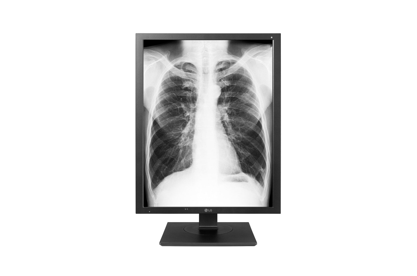 Vorderseite von 21,3 Zoll 3MP Diagnosemonitor mit DICOM-Kennlinie 21HK512D-B