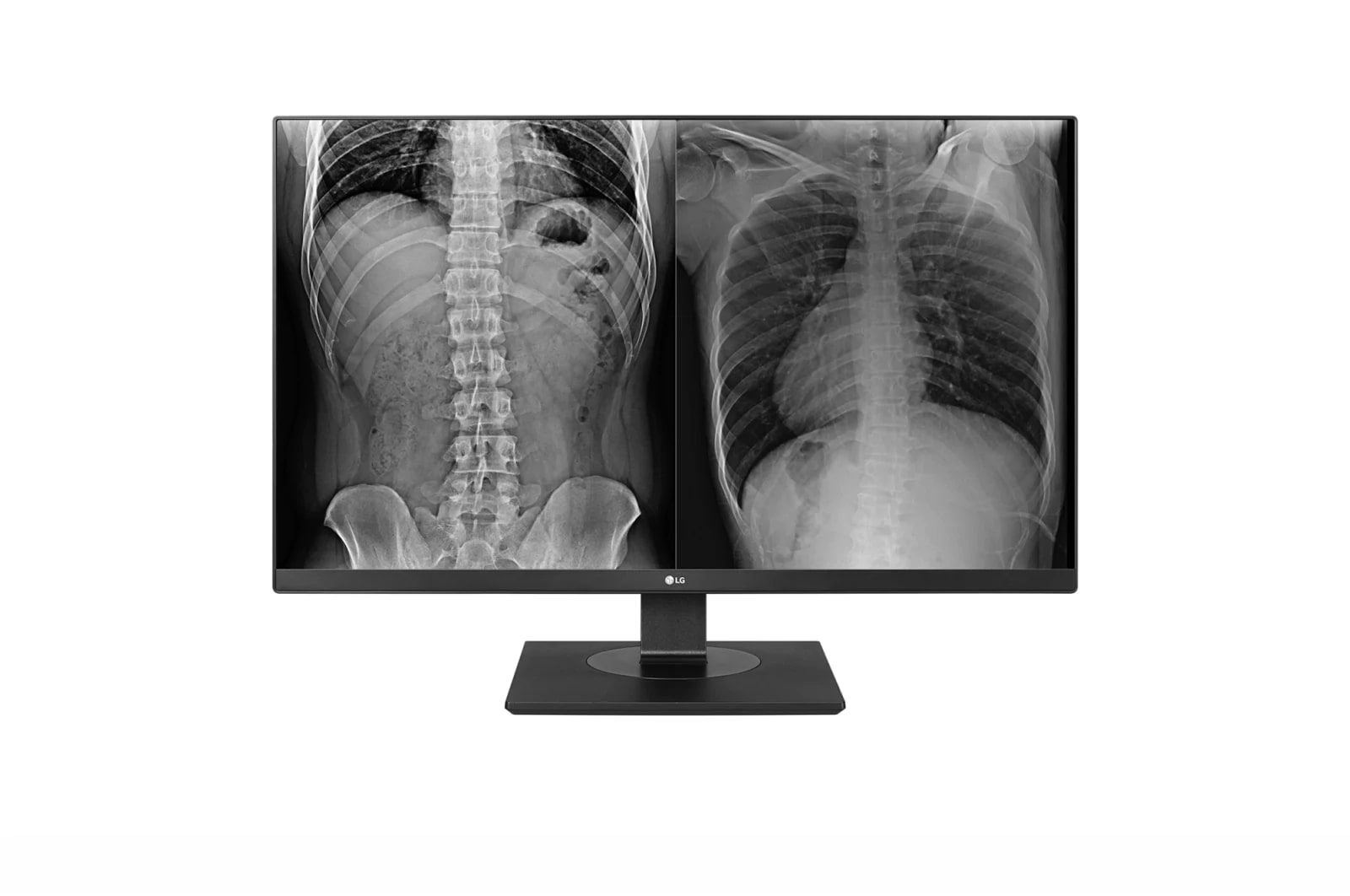 Vorderseite von 27 Zoll Klinischer Prüfmonitor mit IPS und 8 MP 27HJ713C-B