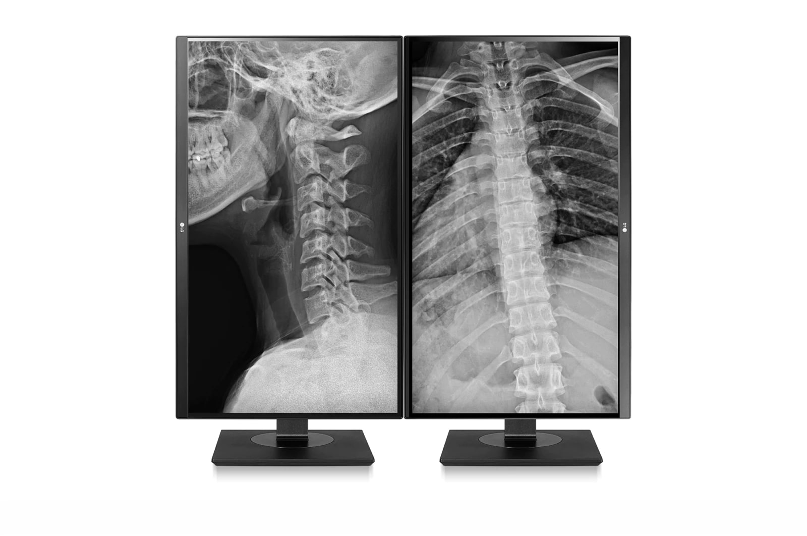 LG 27 Zoll Klinischer Prüfmonitor mit IPS und 8 MP, 27HJ713C-B