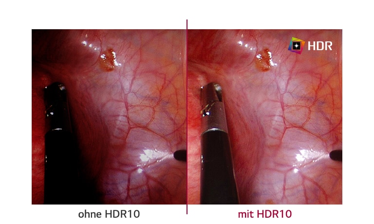 Ohne HDR10 vs. mit HDR10