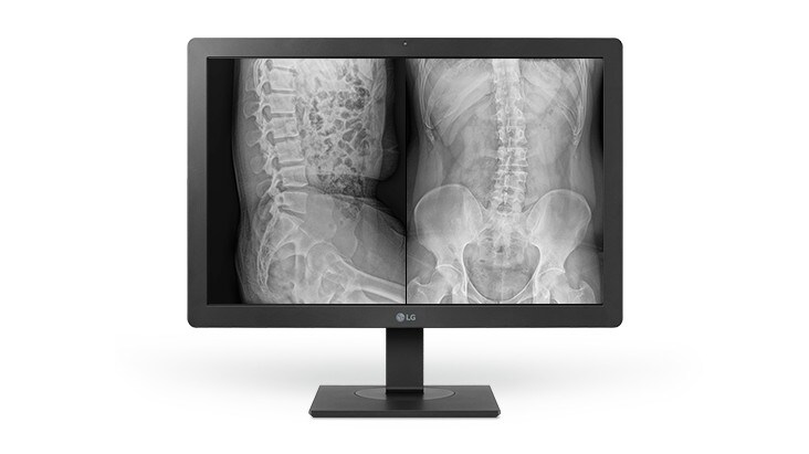 24HR513C har en automatisk luminanssensor, som indstiller skærmens lysstyrke korrekt i forhold til den omgivende belysning.